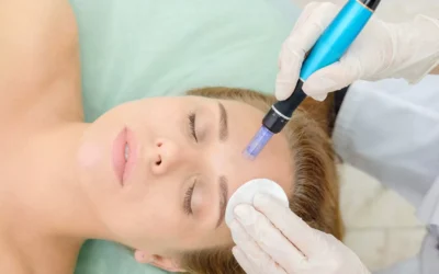 Exploring Microneedling: A Guide to Learning in Southwestern Ontario